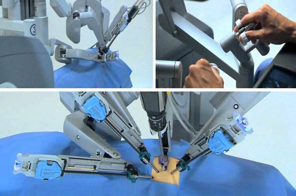 Robot Performing Surgery
