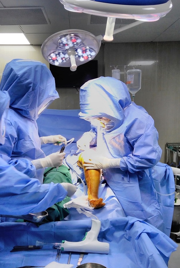 Dr. Giri Performing Knee Replacement after wearing surgical Hood & Helmet.